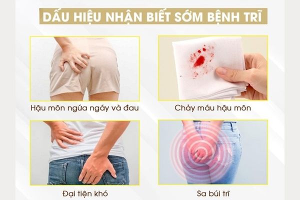 Dấu hiệu bệnh trĩ đặc trưng – Nhận biết sớm điều trị hiệu quả