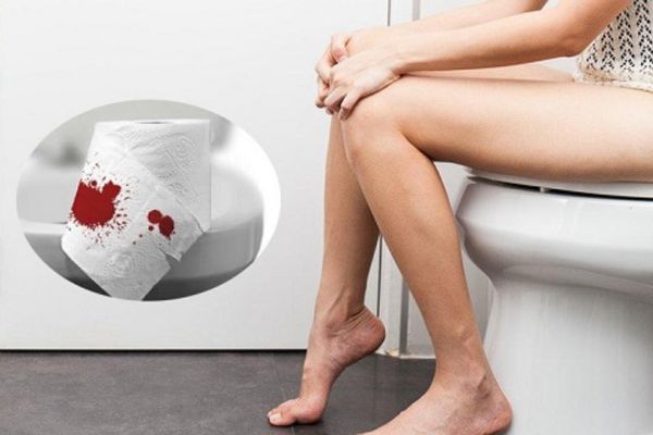 Bệnh trĩ gây ra triệu chứng đại tiện ra máu