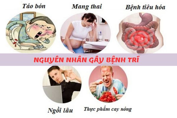 Bệnh trĩ do nhiều nguyên nhân khác nhau gây ra
