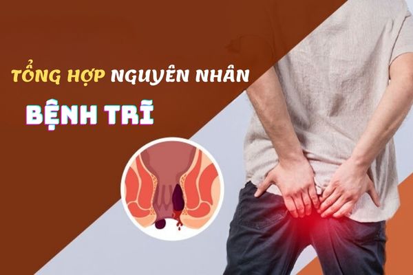 Tổng hợp các nguyên nhân bệnh trĩ cần phải biết