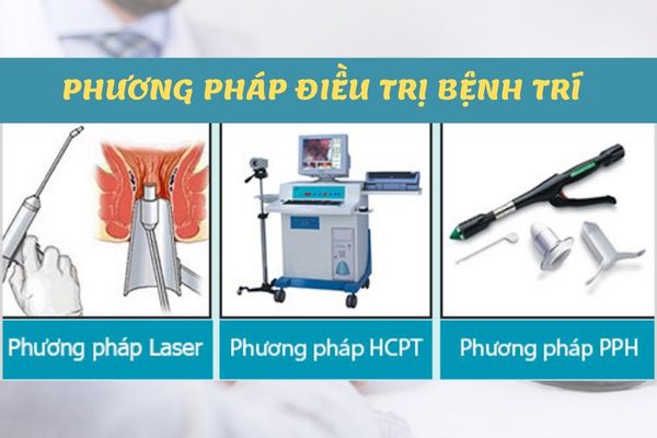 Các phương pháp điều trị bệnh trĩ hiệu quả, an toàn
