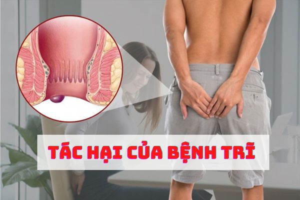 6 tác hại bệnh trĩ nguy hiểm đến sức khỏe cần đặc biệt lưu ý