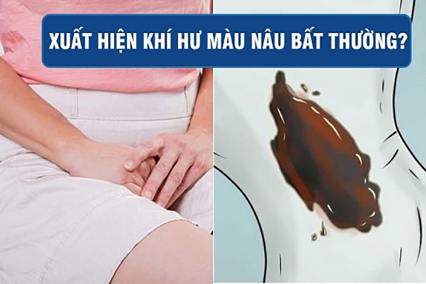 Ra-khi-hu-mau-nau-bat-thuong