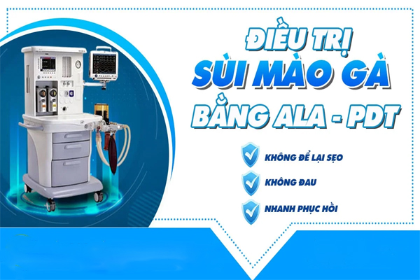 Phương pháp điều trị sùi mào gà hiệu quả tại Phòng Khám Quy Nhơn ở Quy Nhơn