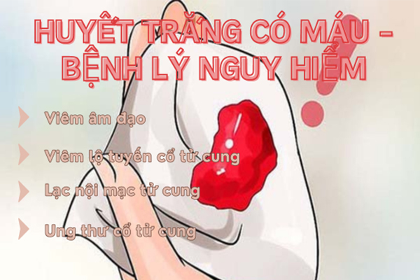 Huyết trắng có máu cảnh báo nhiều bệnh lý nguy hiểm