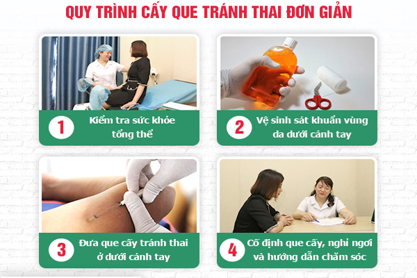 Quy trình cấy que chuẩn khoa học tại Phòng Khám Đa Khoa Quy Nhơn