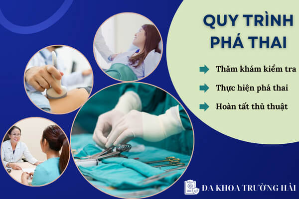Quy trình phá thai tại Phòng Khám Đa Khoa Quy Nhơn