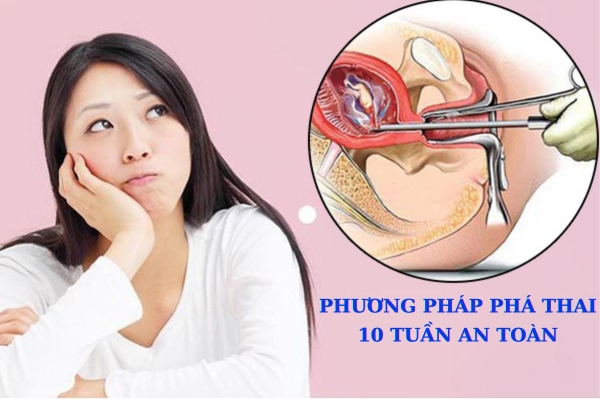 Phương pháp phá thai 10 tuần tuổi an toàn