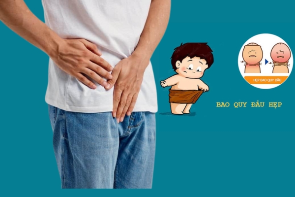 Địa chỉ cắt hẹp bao quy đầu uy tín, an toàn, thẩm mỹ