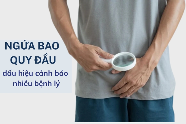 Ngứa bao quy đầu là bị bệnh gì và cách điều trị